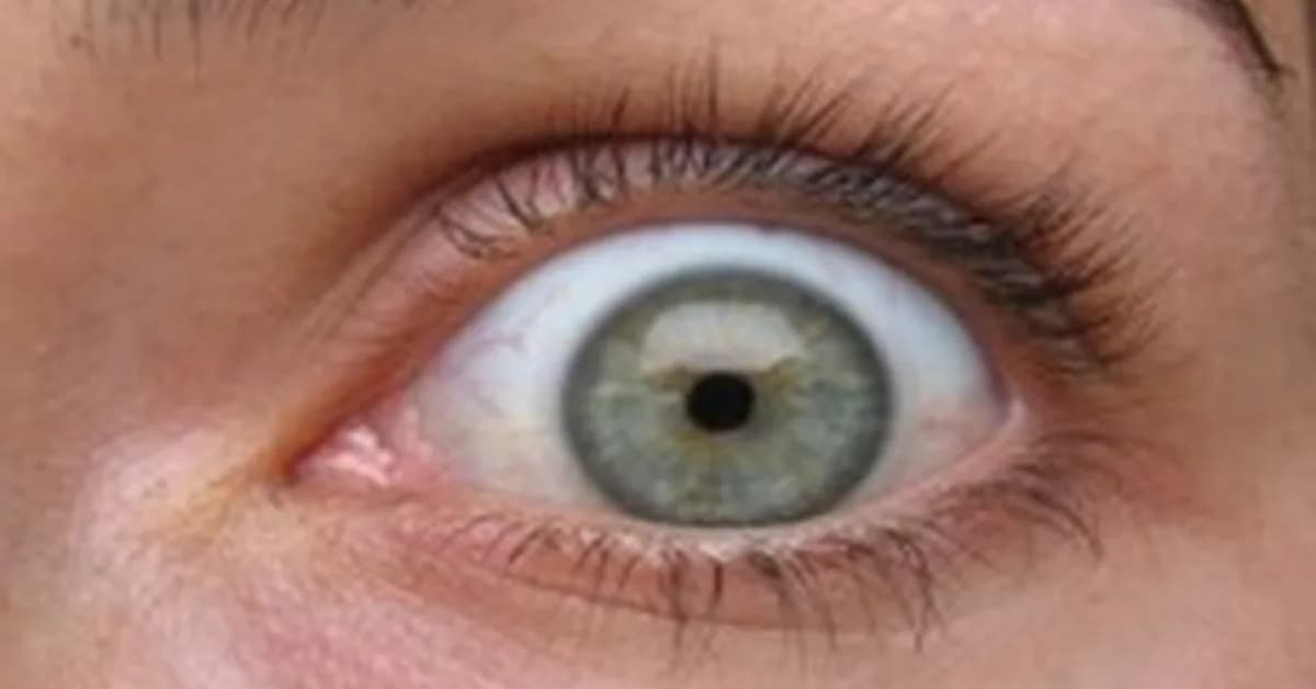 Man used massage gun on his tired eyeballs. It went as well as you'd expect.