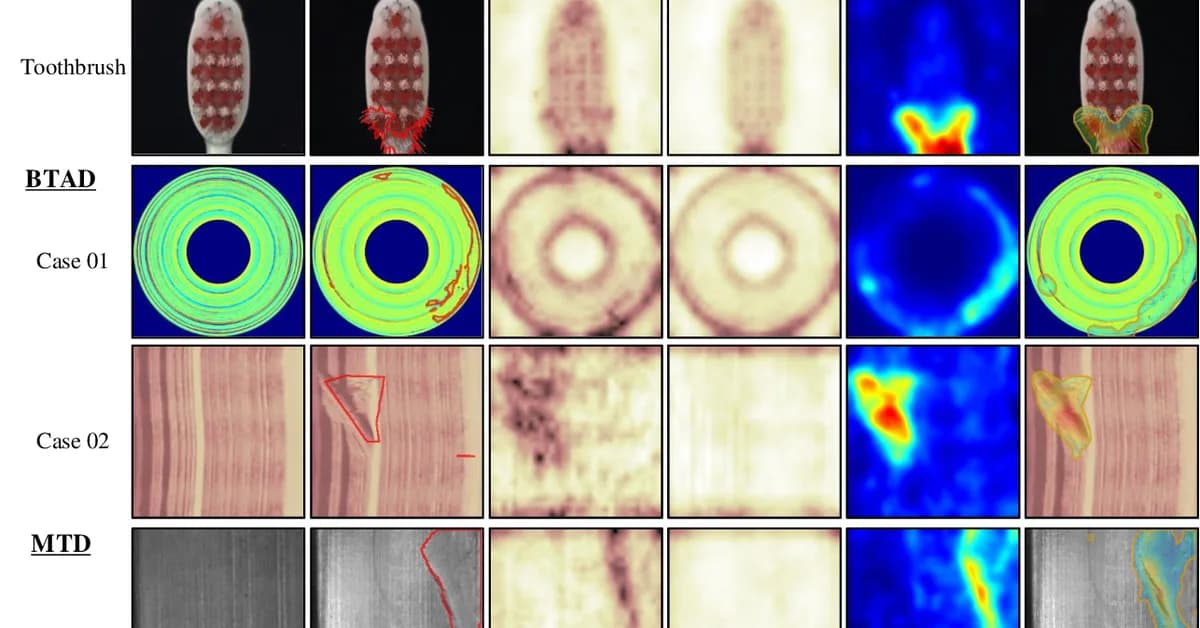 Subspace-Guided Feature Reconstruction for Unsupervised Anomaly Localization