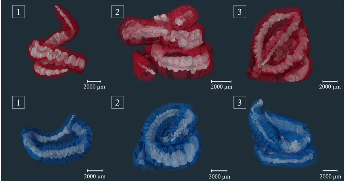 Earthworms Don't Bio-Accumulate Microplastics, So There May be Hope For Us