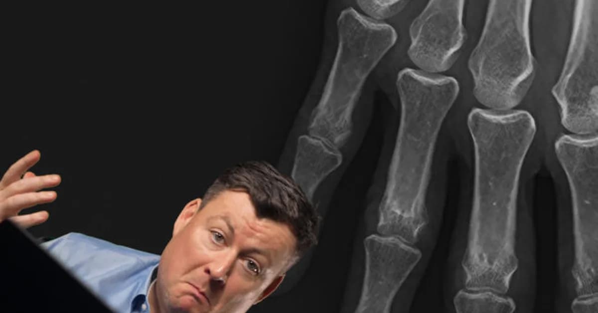 STAT reporter goes up against radiologists to spot deepfake X-rays