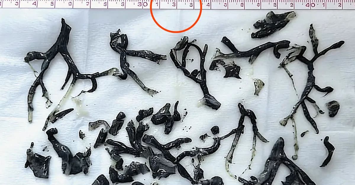 New England Journal of Medicine Retracts Paper Because Photo of Patient's Insides Was Garbled by AI