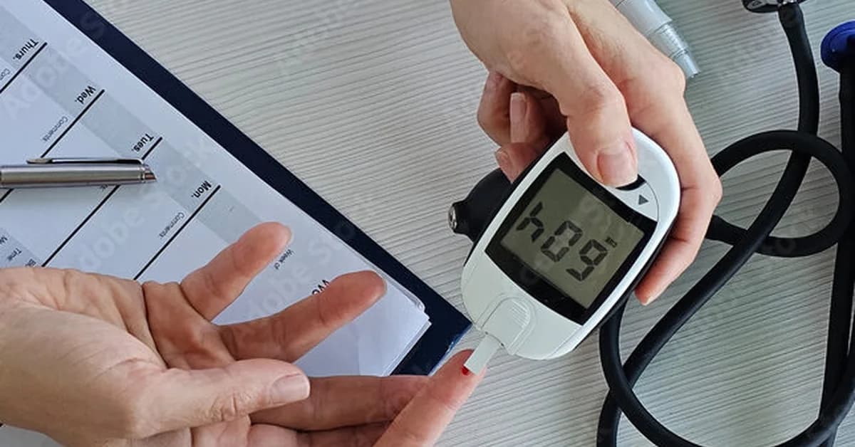 STAT+: New obesity tool aims to predict risk of 18 serious complications