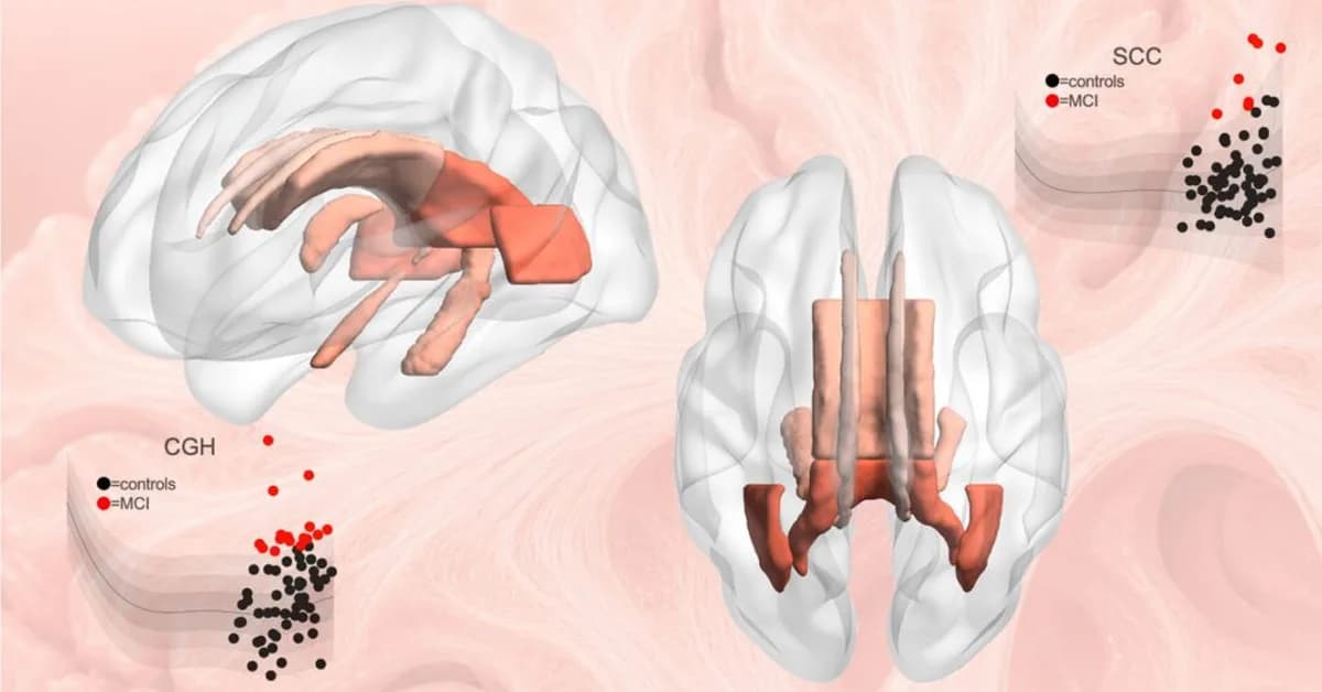 Disease Detection Gets Boost from Keck's New Brain Reference Map