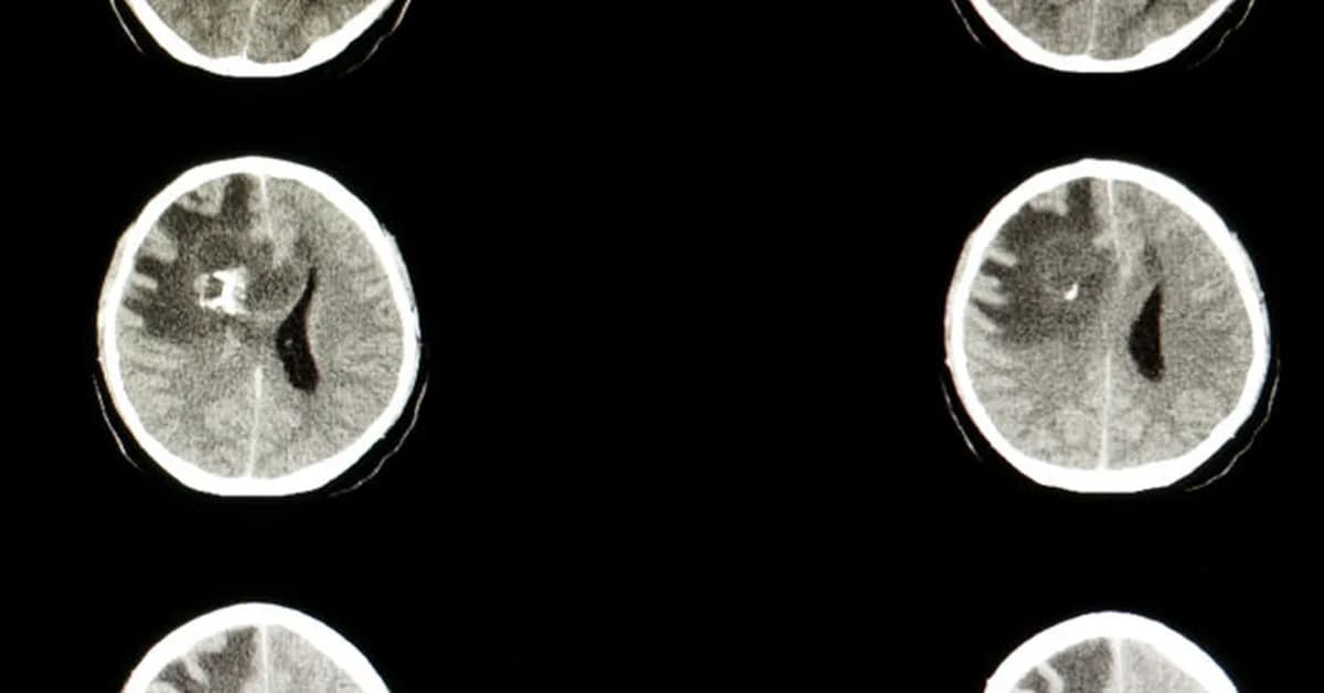 STAT+: Servier to acquire Day One, maker of pediatric cancer drug, for $2.5B