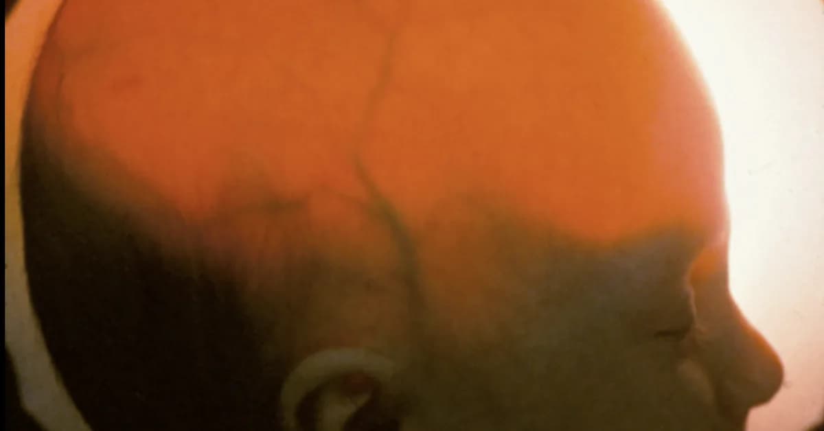 Inside the stealthy startup that pitched brainless human clones