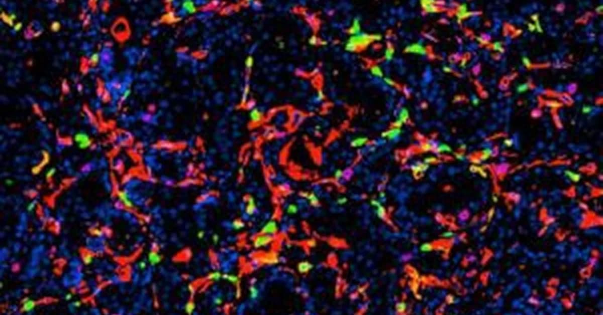 Silica Nanoparticles Induce Ferroptosis, Reprogram Immunity in Prostate Cancer Models