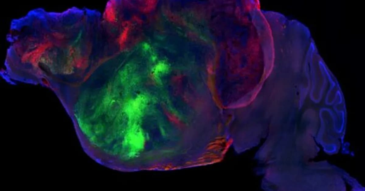 Researchers swap in human brain cells for a mouse's cortex