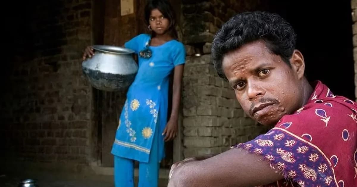 Communities unite to address stigma and discrimination affecting people with neglected tropical diseases