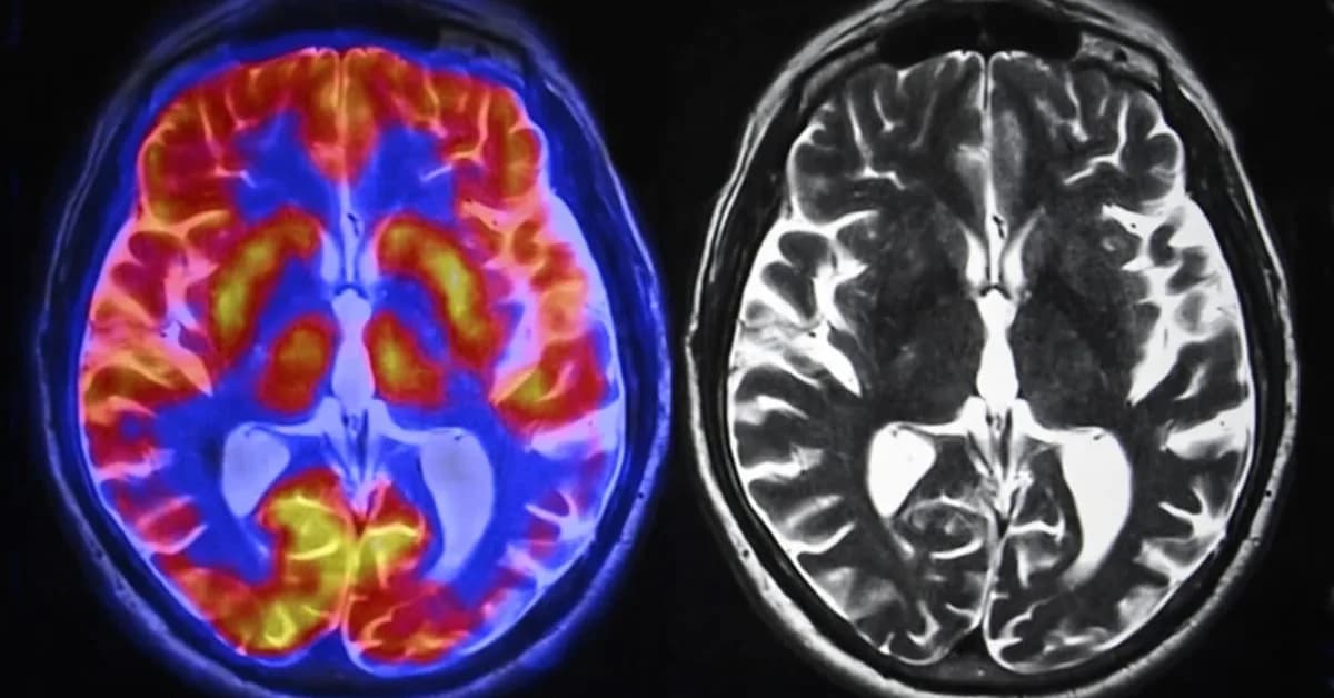 What the Studies Say About How AI Affects Your Brain: A (Very Big) Compilation