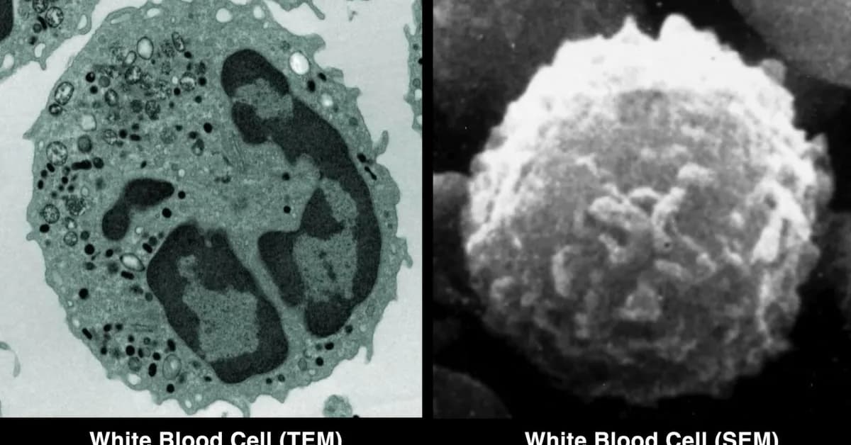 Converting a Scanning Electron Microscope Into a TEM is Surprisingly Easy