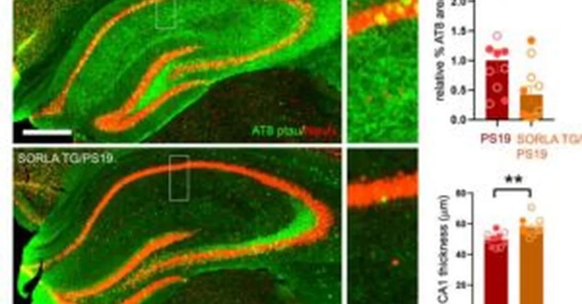Protein Protects Against Tau Tangles, Synaptic Loss in Mouse Model of Tauopathy