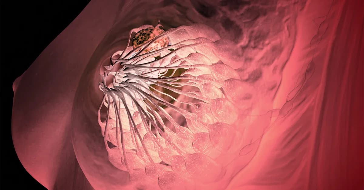 No Survival Benefit in Advanced Breast Cancer With Frontline CDK4/6 Inhibition