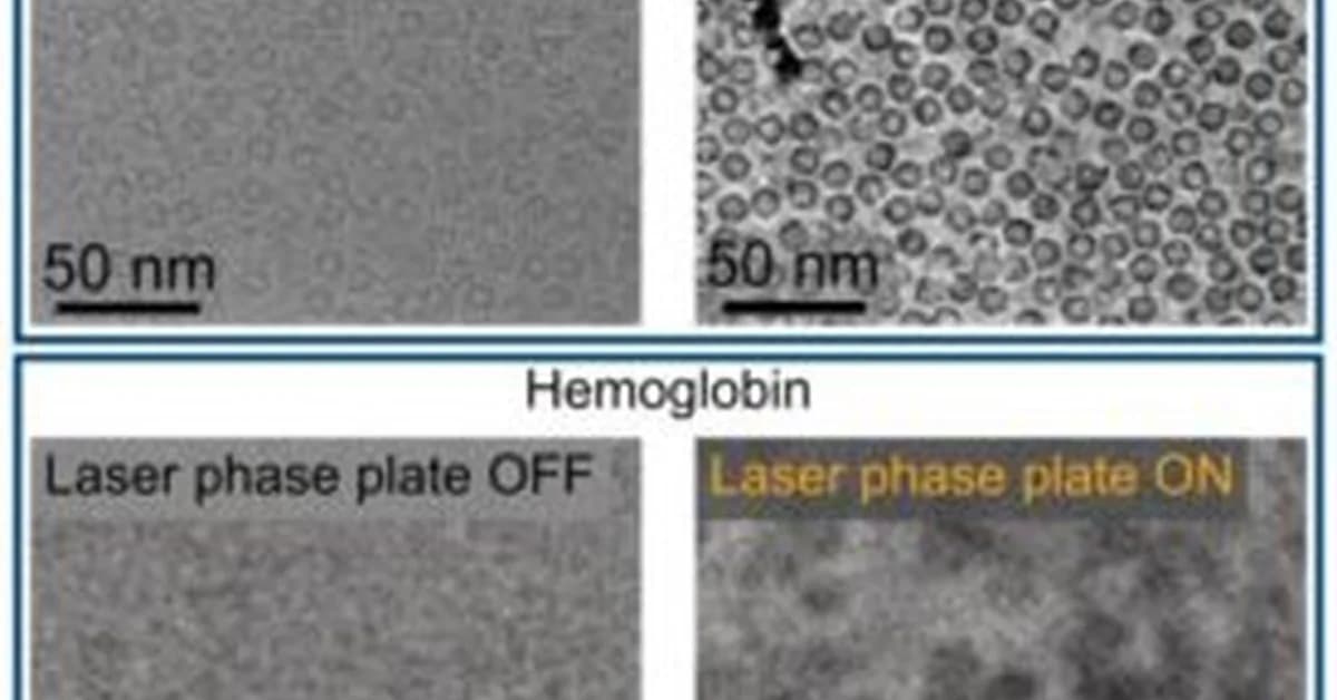 Laser‑Driven Phase Contrast Enhances Cryo‑EM Resolution of Small Proteins