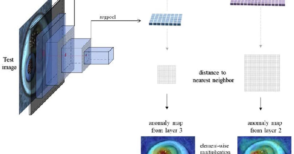 TinyGLASS: Real-Time Self-Supervised In-Sensor Anomaly Detection
